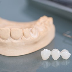 Dental bridge next to cast of lower teeth on a reflective grey surface